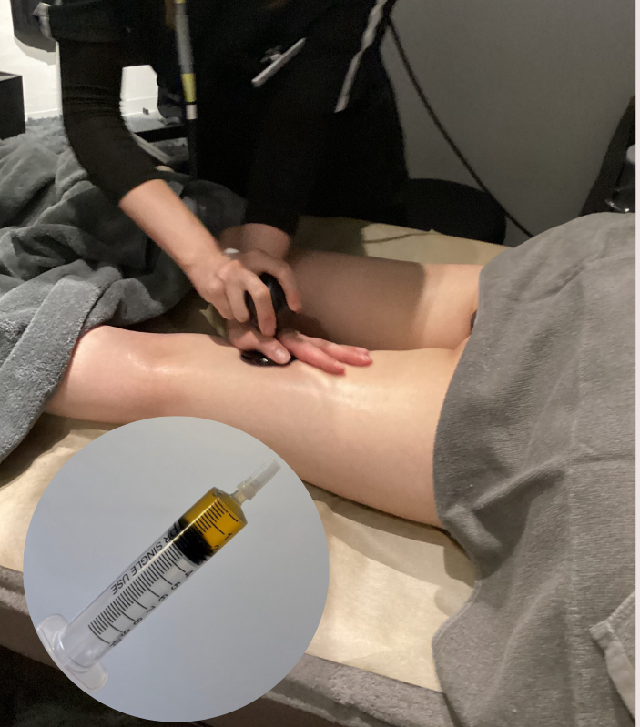 脂肪溶解×ラジオ波（ボディ）内臓ケア付き 15㏄ （ 太もも全面など）