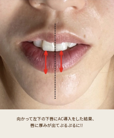 ACトリートメント+センシティブ